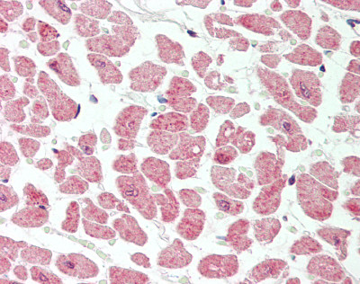 VPS29 Antibody - Human Heart: Formalin-Fixed, Paraffin-Embedded (FFPE).  This image was taken for the unconjugated form of this product. Other forms have not been tested.