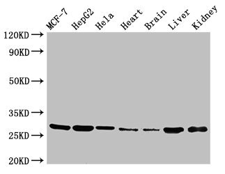 VPS29 Antibody - Western Blot Positive WB detected in:MCF-7 whole cell lysate,HepG2 whole cell lysate,Hela whole cell lysate,Mouse heart tissue,Mouse brain tissue,Rat liver tissue,Rat kidney tissue All Lanes:VPS29 antibody at 3.4µg/ml Secondary Goat polyclonal to rabbit IgG at 1/50000 dilution Predicted band size: 21 KDa Observed band size: 28 KDa