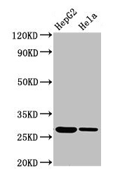 VPS29 Antibody - Western Blot Positive WB detected in: HepG2 whole cell lysate, Hela whole cell lysate All lanes: VPS29 antibody at 3.4µg/ml Secondary Goat polyclonal to rabbit IgG at 1/50000 dilution Predicted band size: 21 kDa Observed band size: 28 kDa