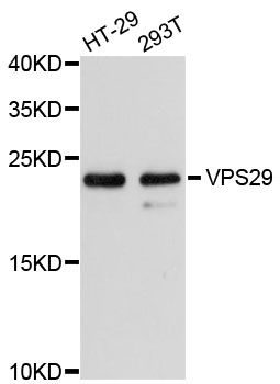 VPS29 Antibody - Western blot analysis of extracts of various cell lines, using VPS29 antibody at 1:3000 dilution. The secondary antibody used was an HRP Goat Anti-Rabbit IgG (H+L) at 1:10000 dilution. Lysates were loaded 25ug per lane and 3% nonfat dry milk in TBST was used for blocking. An ECL Kit was used for detection and the exposure time was 90s.