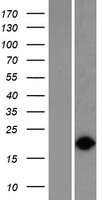 VPS29 Protein - Western validation with an anti-DDK antibody * L: Control HEK293 lysate R: Over-expression lysate