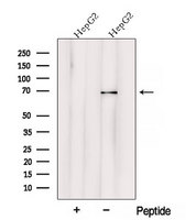 VPS33A Antibody - Western blot analysis of extracts of HepG2 cells using VPS33A antibody. The lane on the left was treated with blocking peptide.