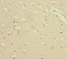 VPS33B Antibody - Immunohistochemistry of paraffin-embedded human brain tissue at dilution of 1:100