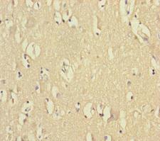 VPS33B Antibody - Immunohistochemistry of paraffin-embedded human brain tissue at dilution of 1:100