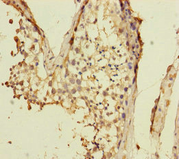 VPS33B Antibody - Immunohistochemistry of paraffin-embedded human testis tissue at dilution of 1:100