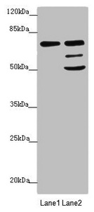 VPS33B Antibody - Western blot All Lanes: VPS33B antibody at 2.72 ug/ml Lane 1: Hela whole cell lysate Lane 2: A549 whole cell lysate Secondary Goat polyclonal to rabbit IgG at 1/10000 dilution Predicted band size: 71,61 kDa Observed band size: 71,51,60 kDa