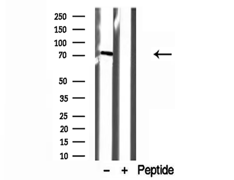 VPS33B Antibody - Western blot analysis of extracts of HeLa cells using VPS33B antibody.