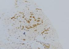 VPS33B Antibody - 1:100 staining human lung tissue by IHC-P. The sample was formaldehyde fixed and a heat mediated antigen retrieval step in citrate buffer was performed. The sample was then blocked and incubated with the antibody for 1.5 hours at 22°C. An HRP conjugated goat anti-rabbit antibody was used as the secondary.
