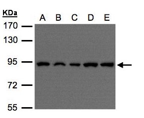 VPS35 Antibody - Sample (30 ug of whole cell lysate). A: H1299, B: HeLa S3 , C: Hep G2 , D: MOLT4 , E: Raji . 7.5% SDS PAGE. VPS35 antibody diluted at 1:500