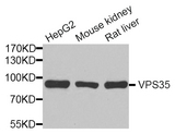VPS35 Antibody - Western blot analysis of extracts of various cell lines.
