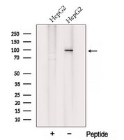 VPS35 Antibody - Western blot analysis of extracts of HepG2 cells using VPS35 antibody. The lane on the left was treated with blocking peptide.