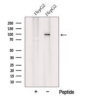 VPS35 Antibody - Western blot analysis of extracts of HepG2 cells using VPS35 antibody. The lane on the left was treated with blocking peptide.