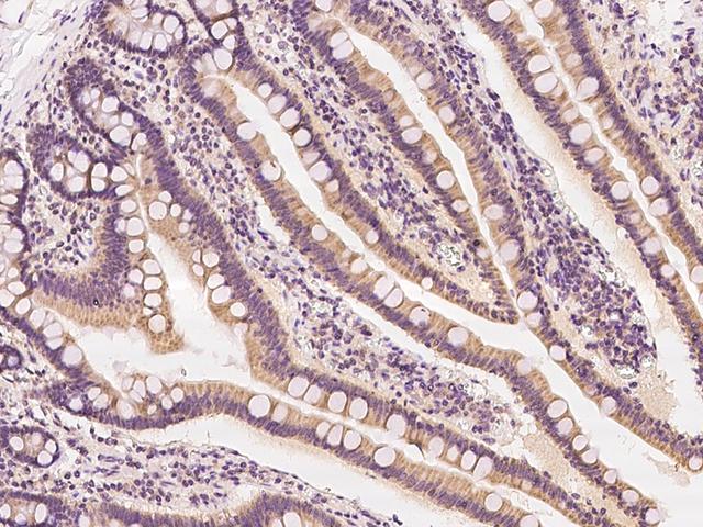 VPS35 Antibody - Immunochemical staining of human VPS35 in human duodenum with rabbit polyclonal antibody at 1:100 dilution, formalin-fixed paraffin embedded sections.
