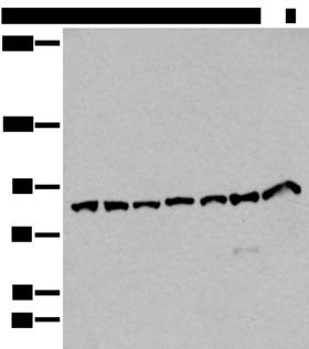 VPS35 Antibody - Western blot analysis of Hela HEPG2 Raji NIH/3T3 and A549 cell lysates Human cerebella tissue and Mouse brain tissue lysates  using VPS35 Polyclonal Antibody at dilution of 1:250