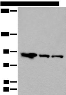 VPS35 Antibody - Western blot analysis of Mouse brain tissue Human cerebella tissue A549 cell lysates  using VPS35 Polyclonal Antibody at dilution of 1:200