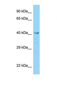 VPS36 Antibody - VPS36 antibody Western blot of Mouse Liver lysate. Antibody concentration 1 ug/ml.  This image was taken for the unconjugated form of this product. Other forms have not been tested.
