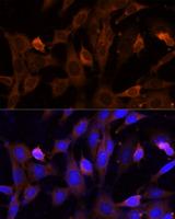 VPS36 Antibody - Immunofluorescence analysis of NIH/3T3 cells using VPS36 Polyclonal Antibody at dilution of 1:100 (40x lens).Blue: DAPI for nuclear staining.