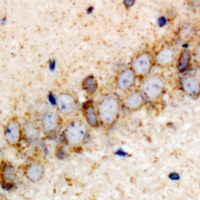 VPS37A Antibody - Immunohistochemical analysis of VPS37A staining in rat brain formalin fixed paraffin embedded tissue section. The section was pre-treated using heat mediated antigen retrieval with sodium citrate buffer (pH 6.0). The section was then incubated with the antibody at room temperature and detected using an HRP conjugated compact polymer system. DAB was used as the chromogen. The section was then counterstained with hematoxylin and mounted with DPX.
