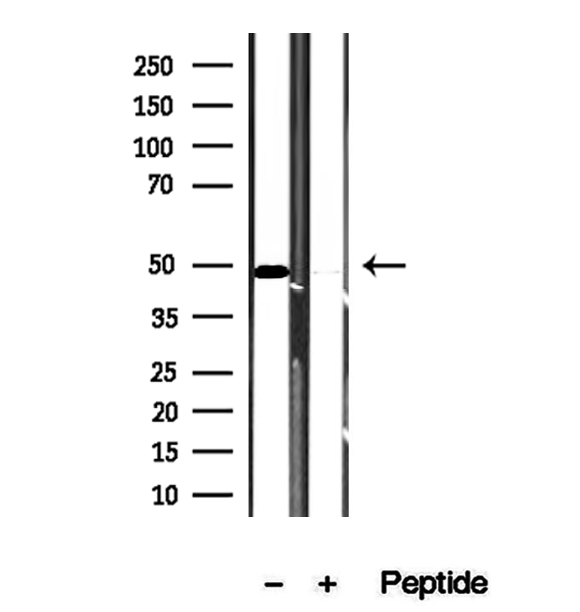 VPS37A Antibody - Western blot analysis of extracts of mouse liver tissue using VPS37A antibody.