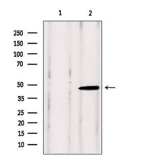 VPS37A Antibody - Western blot analysis of extracts of rat brain tissue using VPS37A antibody. Lane 1 was treated with the blocking peptide.