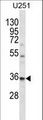 VPS37B Antibody - VPS37B Antibody western blot of U251 cell line lysates (35 ug/lane). The VPS37B antibody detected the VPS37B protein (arrow).