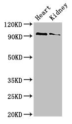 VPS39 Antibody - Western Blot Positive WB detected in:Mouse heart tissue,Mouse kidney tissue All Lanes:VPS39 antibody at 3µg/ml Secondary Goat polyclonal to rabbit IgG at 1/50000 dilution Predicted band size: 102,101 KDa Observed band size: 102 KDa