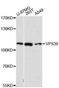 VPS39 Antibody - Western blot analysis of extracts of various cell lines, using VPS39 antibody at 1:3000 dilution. The secondary antibody used was an HRP Goat Anti-Rabbit IgG (H+L) at 1:10000 dilution. Lysates were loaded 25ug per lane and 3% nonfat dry milk in TBST was used for blocking. An ECL Kit was used for detection and the exposure time was 90s.