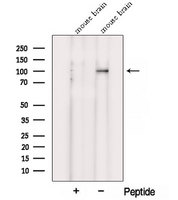 VPS39 Antibody - Western blot analysis of extracts of mouse brain tissue using VPS39 antibody. The lane on the left was treated with blocking peptide.