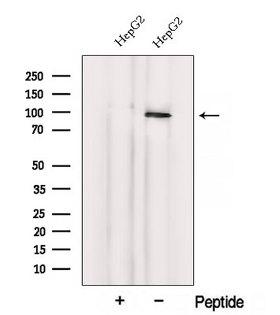 VPS41 Antibody - Western blot analysis of extracts of COS-7 cells using VPS41 antibody. The lane on the left was treated with blocking peptide.