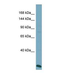 VPS41 Antibody - Western blot of Human ACHN. VPS41 antibody dilution 1.0 ug/ml.  This image was taken for the unconjugated form of this product. Other forms have not been tested.