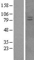 VPS41 Protein - Western validation with an anti-DDK antibody * L: Control HEK293 lysate R: Over-expression lysate