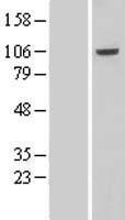 VPS41 Protein - Western validation with an anti-DDK antibody * L: Control HEK293 lysate R: Over-expression lysate