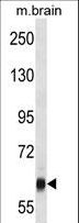 VPS45 Antibody - VPS45 Antibody western blot of mouse brain tissue lysates (35 ug/lane). The VPS45 antibody detected the VPS45 protein (arrow).