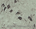 VPS45 Antibody - Rabbit antibody to VPS45A. IHC on rat spinal cord using Rabbit antibody to VPS45Aat a concentration of 10 ug/ml. Pre-absorption of the antibody with the immunizing peptide completely abolishes the immunostaining (not shown).