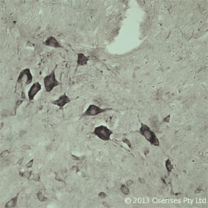 VPS45 Antibody - Rabbit antibody to VPS45A. IHC on rat spinal cord using Rabbit antibody to VPS45Aat a concentration of 10 ug/ml. Pre-absorption of the antibody with the immunizing peptide completely abolishes the immunostaining (not shown).