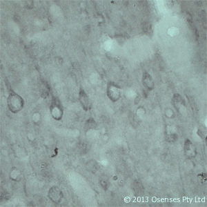 VPS45 Antibody - Rabbit antibody to VPS45A. IHC on rat brain using Rabbit antibody to VPS45Aat a concentration of 10 ug/ml. Pre-absorption of the antibody with the immunizing peptide completely abolishes the immunostaining (not shown).