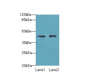 VPS45 Antibody - Western blot. All lanes: VPS45 antibody at 3 ug/ml. Lane 1: Mouse brain tissue. Lane 2: U87 whole cell lysate. Secondary Goat polyclonal to Rabbit IgG at 1:10000 dilution. Predicted band size: 41 kDa. Observed band size: 41 kDa.