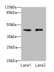 VPS45 Antibody - Western blot All lanes: VPS45 antibody at 3µg/ml Lane 1: Mouse brain tissue Lane 2: U87 whole cell lysate Secondary Goat polyclonal to rabbit IgG at 1/10000 dilution Predicted band size: 66, 62 kDa Observed band size: 41 kDa