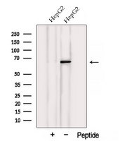 VPS45 Antibody - Western blot analysis of extracts of HepG2 cells using VPS45 antibody. The lane on the left was treated with blocking peptide.