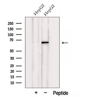 VPS45 Antibody - Western blot analysis of extracts of HepG2 cells using VPS45 antibody. The lane on the left was treated with blocking peptide.