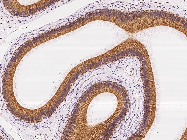 VPS45 Antibody - Immunochemical staining of human VPS45 in human epididymis with rabbit polyclonal antibody at 1:100 dilution, formalin-fixed paraffin embedded sections.