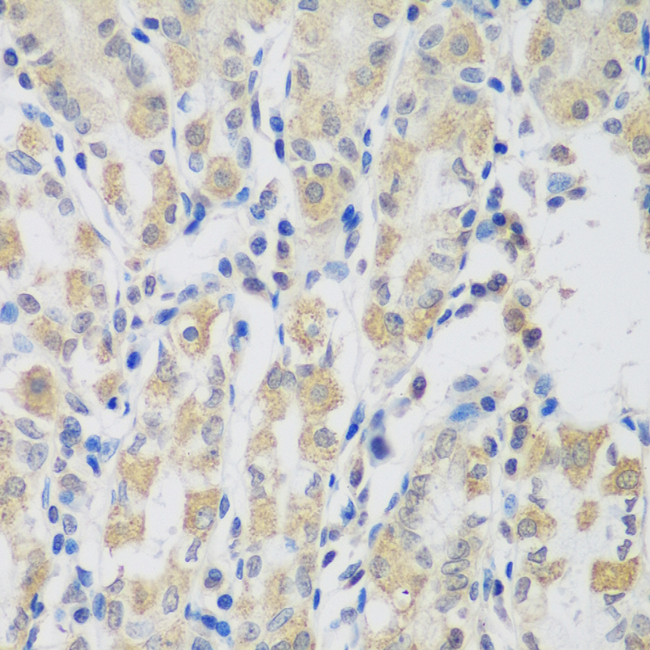 VPS4A Antibody - Immunohistochemistry of paraffin-embedded human stomach tissue.
