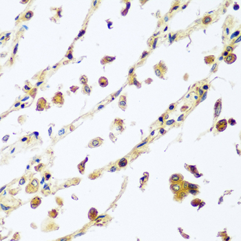 VPS4A Antibody - Immunohistochemistry of paraffin-embedded human lung tissue.
