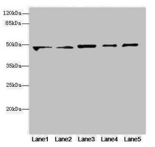 VPS4A Antibody - Western blot All Lanes: VPS4Aantibody at 4.28ug/ml Lane 1 : Mouse kidney tissue Lane 2 : Rat gonadal tissue Lane 3 : Mouse brain tissue Lane 4 : U87 whole cell lysate Lane 5 : MCF7 whole cell lysate Secondary Goat polyclonal to Rabbit IgG at 1/10000 dilution Predicted band size: 49 kDa Observed band size: 49 kDa