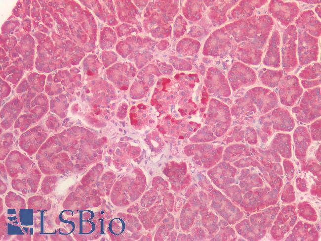 VPS4A Antibody - Human Pancreas: Formalin-Fixed, Paraffin-Embedded (FFPE)