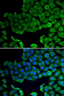 VPS4A Antibody - Immunofluorescence analysis of A549 cells using VPS4A Polyclonal Antibody.