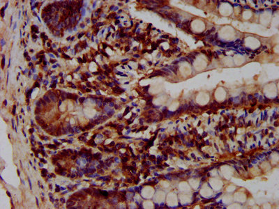 VPS52 / SACM2L Antibody - Immunohistochemistry image at a dilution of 1:200 and staining in paraffin-embedded human small intestine tissue performed on a Leica BondTM system. After dewaxing and hydration, antigen retrieval was mediated by high pressure in a citrate buffer (pH 6.0) . Section was blocked with 10% normal goat serum 30min at RT. Then primary antibody (1% BSA) was incubated at 4 °C overnight. The primary is detected by a biotinylated secondary antibody and visualized using an HRP conjugated SP system.