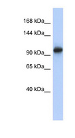 VPS54 Antibody - VPS54 antibody Western blot of Placenta lysate. This image was taken for the unconjugated form of this product. Other forms have not been tested.