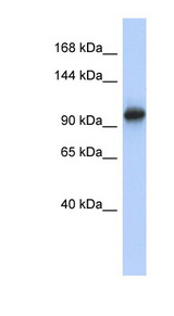 VPS54 Antibody - VPS54 antibody Western blot of Placenta lysate. This image was taken for the unconjugated form of this product. Other forms have not been tested.