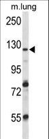 VPS54 Antibody - VPS54 Antibody western blot of mouse lung tissue lysates (35 ug/lane). The VPS54 antibody detected the VPS54 protein (arrow).